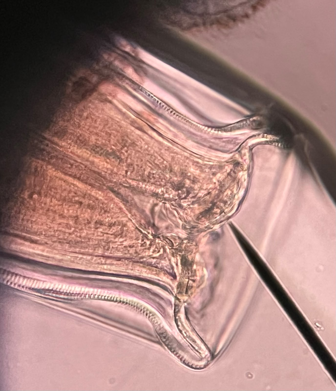 Nematode buccal capsule cleared in glycerin, with cuticle and oesophagus visible in detail, viewed by brightfield microscopy at 40× magnification