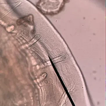 Acquired light-microscopy view of parasite morphology