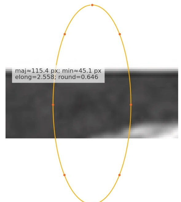 Derived region geometry and landmark overlay