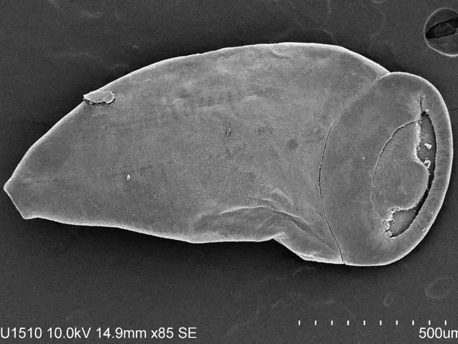 Scanning electron micrograph of a parasite specimen