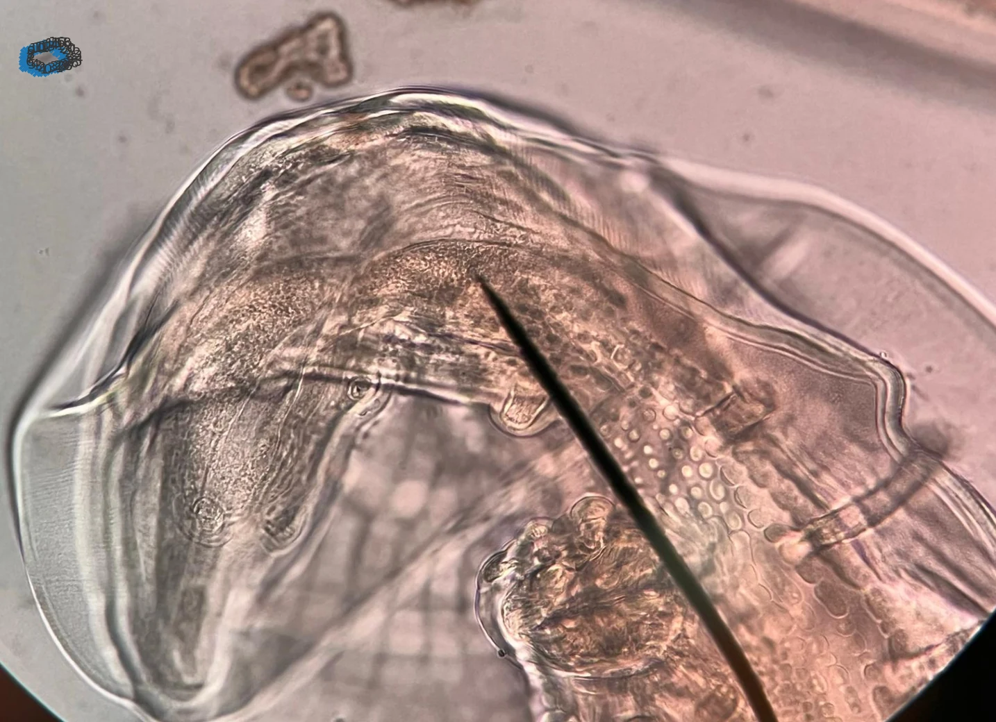 Microscope view of a diagnostic specimen region with pointer